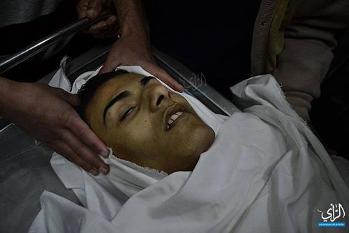 Un martyr et cinq blessés à l'est de Jabaliya